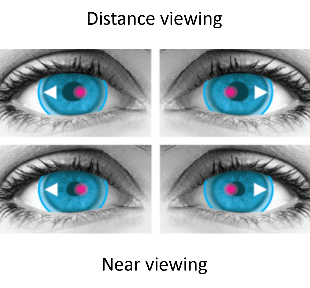 Miru 1mes Mutifocal Miru 1mes Mutifocal